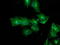 Tubulin Alpha Like 3 antibody, LS-C173512, Lifespan Biosciences, Immunofluorescence image 