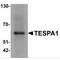 Thymocyte Expressed, Positive Selection Associated 1 antibody, MBS153352, MyBioSource, Western Blot image 