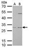 Prohibitin antibody, GTX113243, GeneTex, Western Blot image 