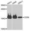 CD59 Molecule (CD59 Blood Group) antibody, A12412, ABclonal Technology, Western Blot image 