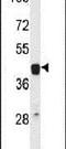 ETS Proto-Oncogene 2, Transcription Factor antibody, PA5-26845, Invitrogen Antibodies, Western Blot image 