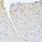 Tubulin Tyrosine Ligase Like 12 antibody, 23-455, ProSci, Immunohistochemistry paraffin image 