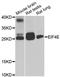 Eukaryotic Translation Initiation Factor 4E antibody, LS-C746850, Lifespan Biosciences, Western Blot image 