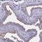 Transmembrane Protein 138 antibody, NBP1-92528, Novus Biologicals, Immunohistochemistry paraffin image 