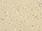 RNF36 antibody, LS-C676648, Lifespan Biosciences, Immunohistochemistry paraffin image 