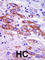 Casein Kinase 1 Delta antibody, abx033376, Abbexa, Western Blot image 