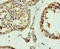 Tubulin Beta 3 Class III antibody, LS-C211968, Lifespan Biosciences, Immunohistochemistry paraffin image 