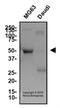 TNF Receptor Superfamily Member 11b antibody, NB100-56505, Novus Biologicals, Western Blot image 