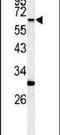 Receptor Interacting Serine/Threonine Kinase 3 antibody, PA5-14955, Invitrogen Antibodies, Western Blot image 