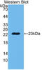 Peptidoglycan Recognition Protein 1 antibody, LS-C314972, Lifespan Biosciences, Western Blot image 