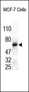 Matrix Metallopeptidase 14 antibody, 251938, Abbiotec, Western Blot image 
