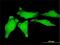 Y-Box Binding Protein 1 antibody, H00004904-M02, Novus Biologicals, Immunofluorescence image 