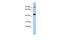 Potassium Voltage-Gated Channel Subfamily H Member 2 antibody, GTX47633, GeneTex, Western Blot image 