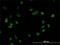 Cleavage Stimulation Factor Subunit 3 antibody, H00001479-M01, Novus Biologicals, Immunofluorescence image 