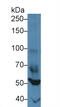 Forkhead Box P1 antibody, abx131045, Abbexa, Western Blot image 