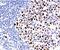 MutL Homolog 1 antibody, ab14206, Abcam, Immunohistochemistry paraffin image 