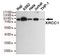 X-Ray Repair Cross Complementing 1 antibody, STJ99239, St John