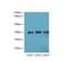 Nucleoporin 35 antibody, LS-C399806, Lifespan Biosciences, Western Blot image 