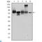Junction Plakoglobin antibody, LS-C812522, Lifespan Biosciences, Enzyme Linked Immunosorbent Assay image 