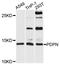 Podoplanin antibody, A7166, ABclonal Technology, Western Blot image 