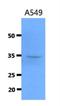 Cathepsin S antibody, NBP2-42634, Novus Biologicals, Western Blot image 