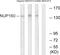 Nucleoporin 160 antibody, GTX87027, GeneTex, Western Blot image 