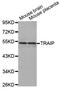 TRAF Interacting Protein antibody, LS-C332519, Lifespan Biosciences, Western Blot image 