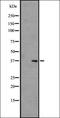 Olfactory Receptor Family 5 Subfamily H Member 6 (Gene/Pseudogene) antibody, orb335641, Biorbyt, Western Blot image 