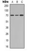 Interleukin 2 Receptor Subunit Beta antibody, orb338915, Biorbyt, Western Blot image 