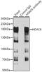 Histone Deacetylase 6 antibody, GTX02885, GeneTex, Immunoprecipitation image 