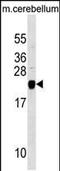 Transgelin 3 antibody, PA5-49007, Invitrogen Antibodies, Western Blot image 