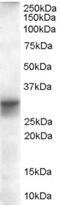 Four And A Half LIM Domains 1 antibody, 46-380, ProSci, Enzyme Linked Immunosorbent Assay image 