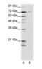Nuclear Receptor Subfamily 2 Group C Member 1 antibody, PA1-24354, Invitrogen Antibodies, Western Blot image 