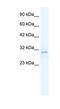 Transient Receptor Potential Cation Channel Subfamily M Member 3 antibody, NBP1-80210, Novus Biologicals, Western Blot image 