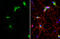 Collagen Type VI Alpha 1 Chain antibody, GTX109963, GeneTex, Immunofluorescence image 