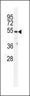 Tubulin Beta 1 Class VI antibody, LS-C161723, Lifespan Biosciences, Western Blot image 