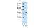 Ribosomal Protein L6 antibody, 29-216, ProSci, Enzyme Linked Immunosorbent Assay image 