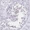 Coiled-coil domain-containing protein 105 antibody, NBP2-32391, Novus Biologicals, Immunohistochemistry frozen image 
