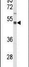 Solute Carrier Family 39 Member 8 antibody, PA5-26368, Invitrogen Antibodies, Western Blot image 