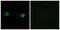 Abhydrolase Domain Containing 2 antibody, GTX87133, GeneTex, Immunofluorescence image 