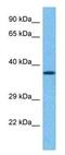Glycoprotein M6A antibody, GTX17572, GeneTex, Western Blot image 