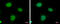 Insulin Like Growth Factor 2 MRNA Binding Protein 3 antibody, GTX115459, GeneTex, Immunofluorescence image 