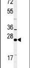 RAB27B, Member RAS Oncogene Family antibody, PA5-24908, Invitrogen Antibodies, Western Blot image 