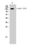 EPH Receptor A7 antibody, A03943Y791, Boster Biological Technology, Western Blot image 