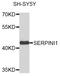Serpin Family I Member 1 antibody, STJ111439, St John