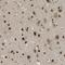 Lysine Acetyltransferase 5 antibody, HPA016953, Atlas Antibodies, Immunohistochemistry paraffin image 