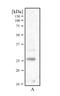 Calcipressin-1 antibody, NBP1-46852, Novus Biologicals, Western Blot image 