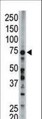 Long-chain-fatty-acid--CoA ligase 6 antibody, LS-C98513, Lifespan Biosciences, Western Blot image 