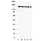 GLI Family Zinc Finger 2 antibody, R31041, NSJ Bioreagents, Western Blot image 