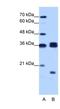Heterogeneous Nuclear Ribonucleoprotein H3 antibody, NBP1-57163, Novus Biologicals, Western Blot image 